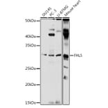 Western Blot - Anti-ACT Antibody (A89381) - Antibodies.com
