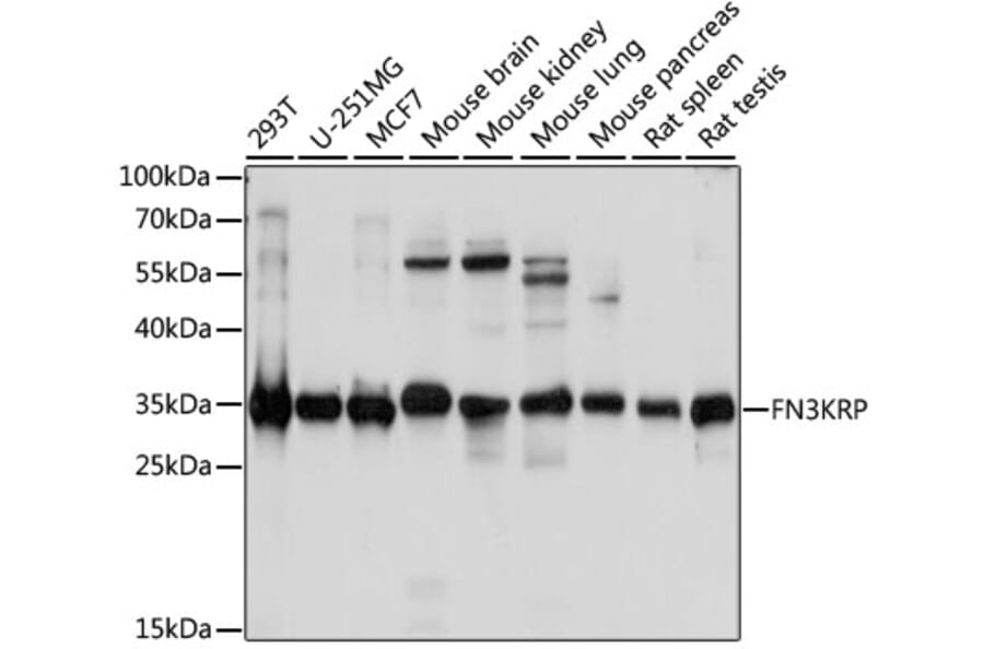 Western Blot - Anti-FN3K-RP Antibody (A89383) - Antibodies.com