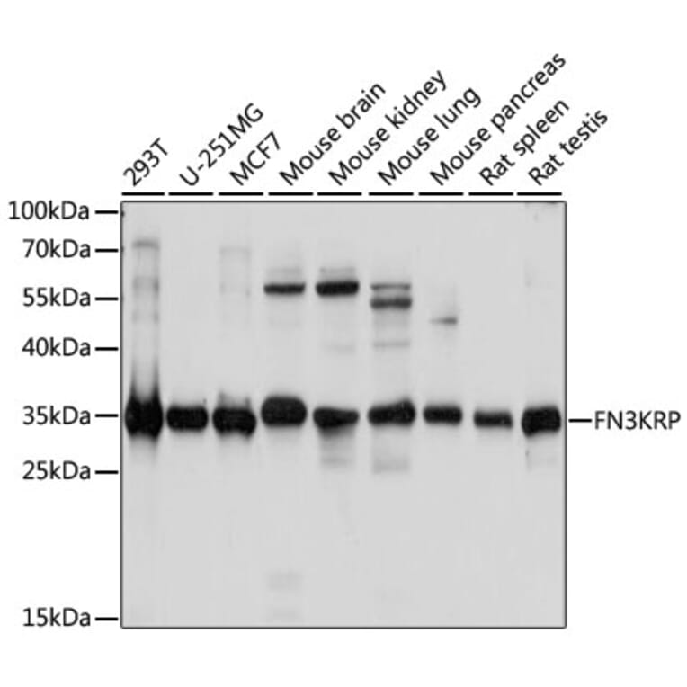 Western Blot - Anti-FN3K-RP Antibody (A89383) - Antibodies.com