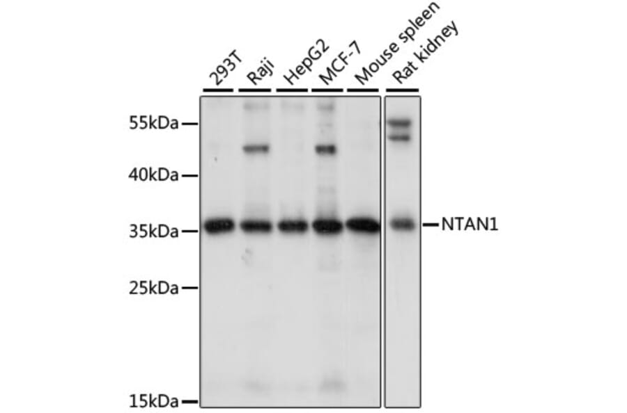 Western Blot - Anti-PNAD Antibody (A89384) - Antibodies.com