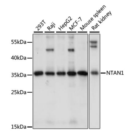 Western Blot - Anti-PNAD Antibody (A89384) - Antibodies.com