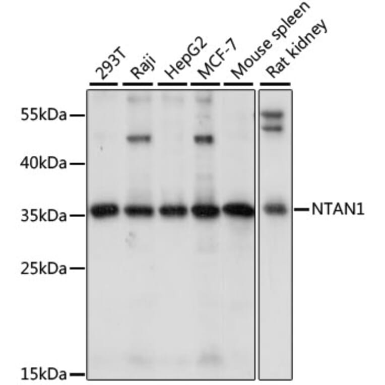 Western Blot - Anti-PNAD Antibody (A89384) - Antibodies.com