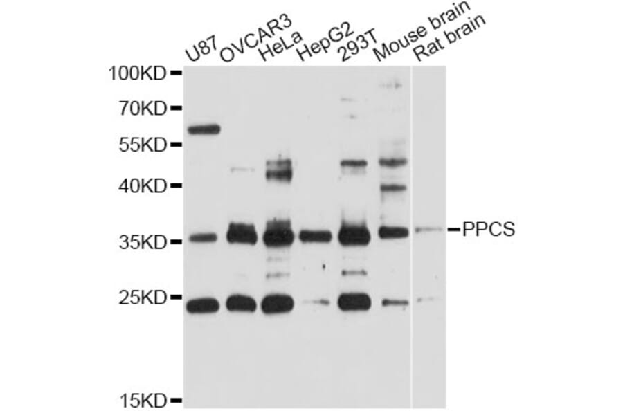 Western Blot - Anti-PPCS Antibody (A12843) - Antibodies.com