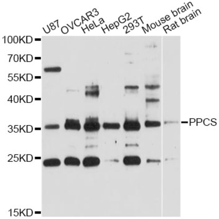 Western Blot - Anti-PPCS Antibody (A12843) - Antibodies.com