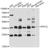Western Blot - Anti-PPCS Antibody (A12843) - Antibodies.com