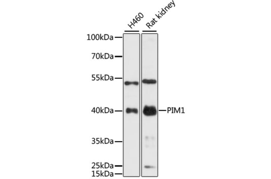 Western Blot - Anti-PIM1 Antibody (A89386) - Antibodies.com