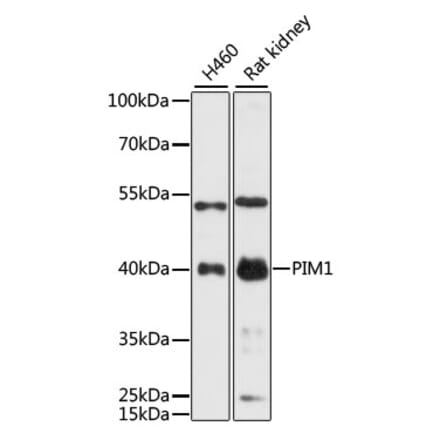 Western Blot - Anti-PIM1 Antibody (A89386) - Antibodies.com