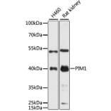 Western Blot - Anti-PIM1 Antibody (A89386) - Antibodies.com