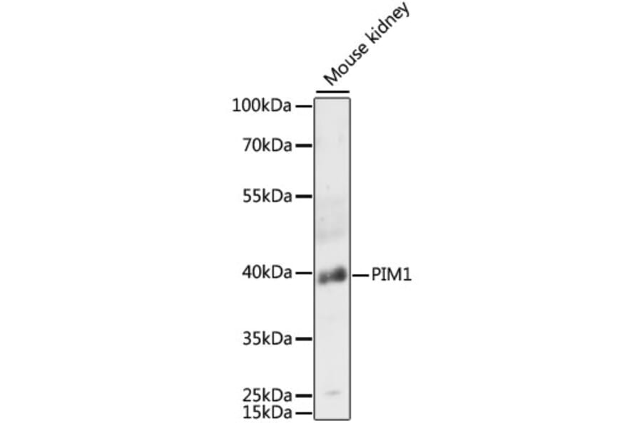 Western Blot - Anti-PIM1 Antibody (A89386) - Antibodies.com