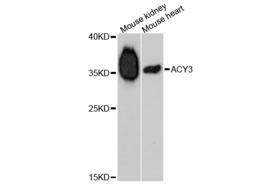 Western Blot - Anti-ACY3 Antibody (A5084) - Antibodies.com