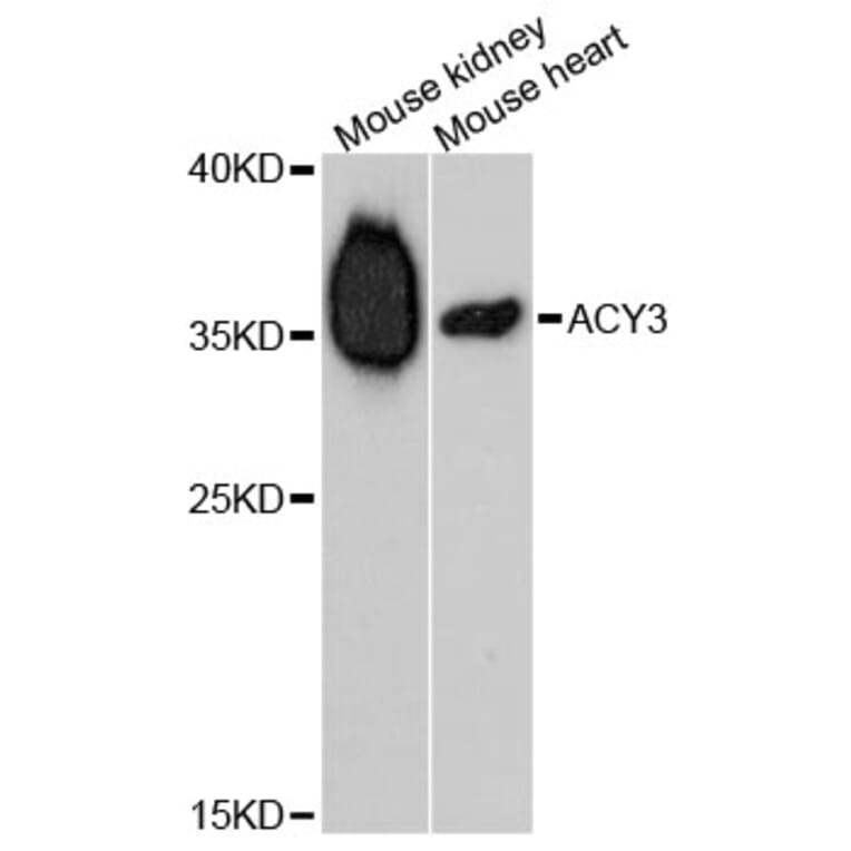 Western Blot - Anti-ACY3 Antibody (A5084) - Antibodies.com