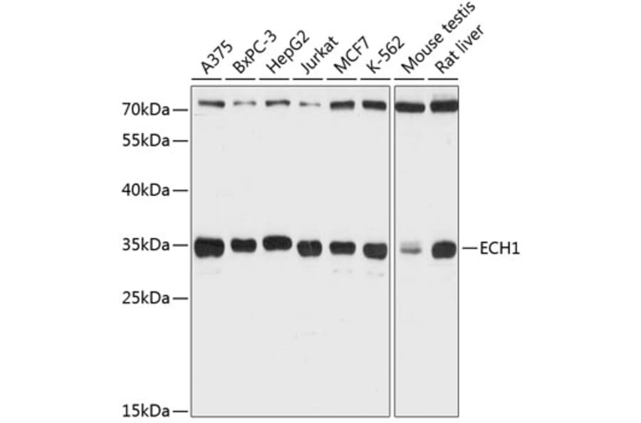 Western Blot - Anti-ECH1 Antibody (A89388) - Antibodies.com