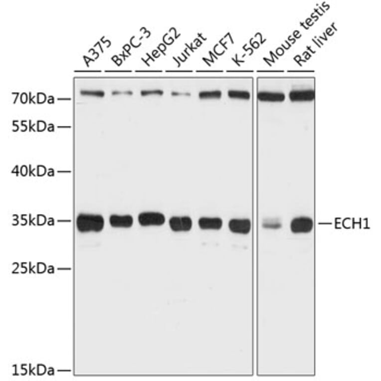 Western Blot - Anti-ECH1 Antibody (A89388) - Antibodies.com