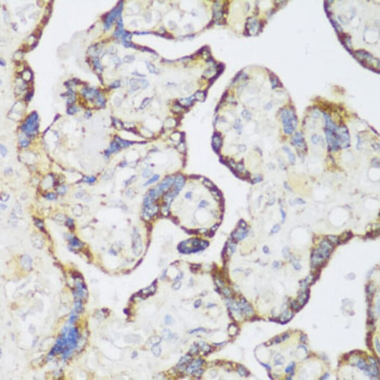 Immunohistochemistry - Anti-ECH1 Antibody (A89388) - Antibodies.com