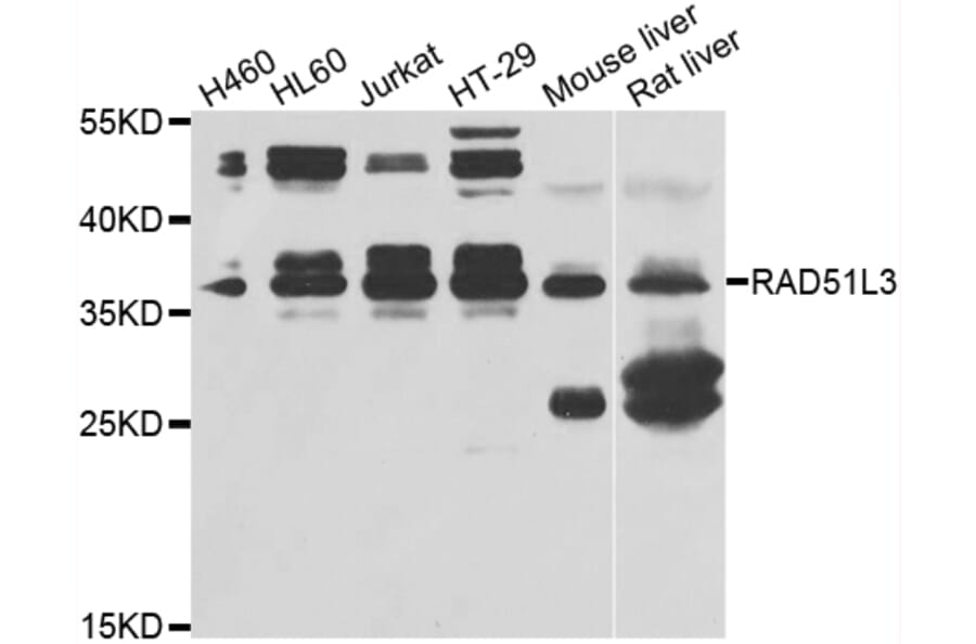 Western Blot - Anti-Rad51D Antibody (A4068) - Antibodies.com
