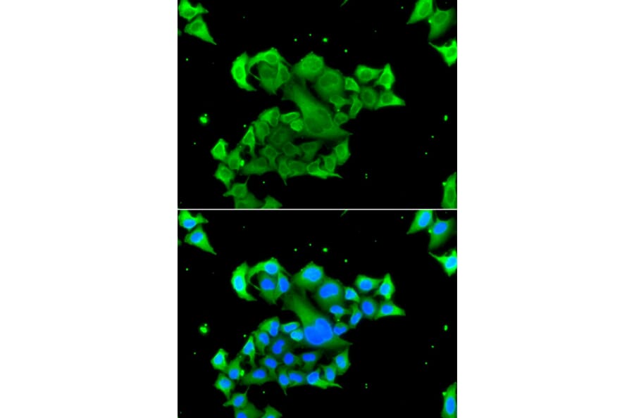Immunofluorescence - Anti-Rad51D Antibody (A4068) - Antibodies.com