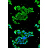 Immunofluorescence - Anti-Rad51D Antibody (A4068) - Antibodies.com