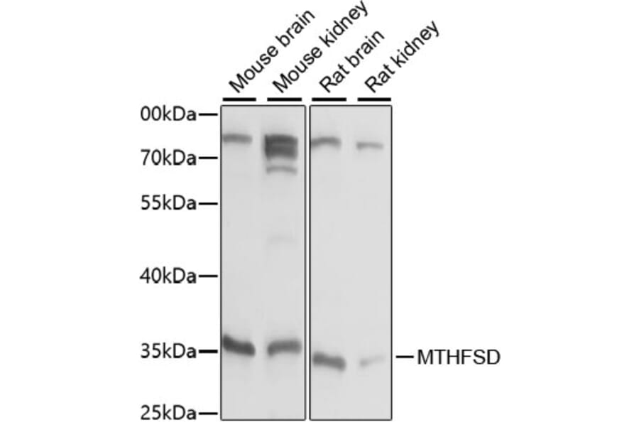 Western Blot - Anti-MTHFSD Antibody (A89390) - Antibodies.com