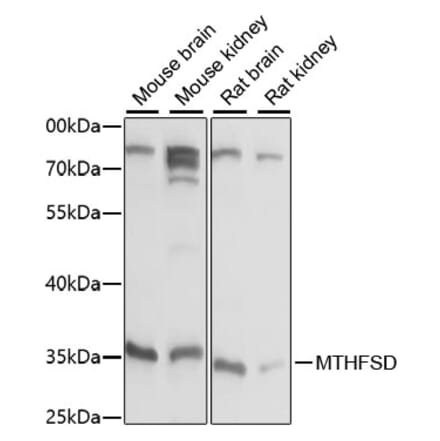 Western Blot - Anti-MTHFSD Antibody (A89390) - Antibodies.com