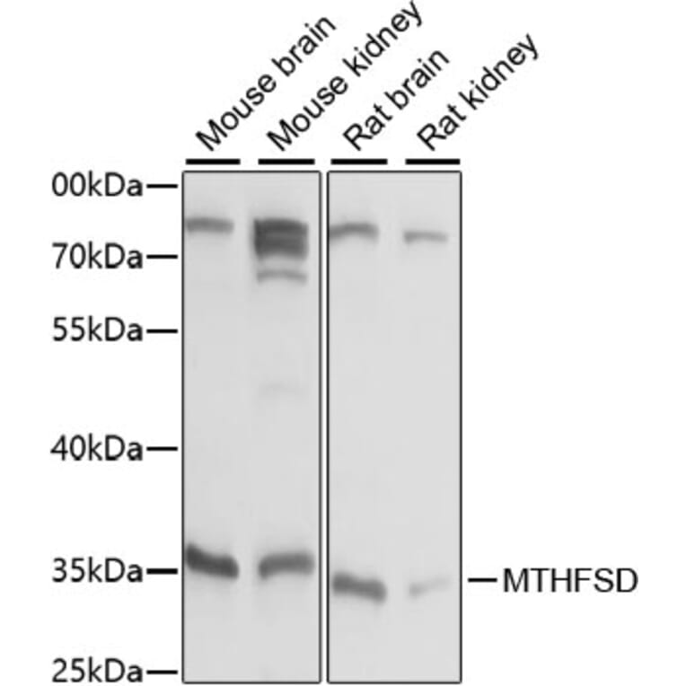 Western Blot - Anti-MTHFSD Antibody (A89390) - Antibodies.com