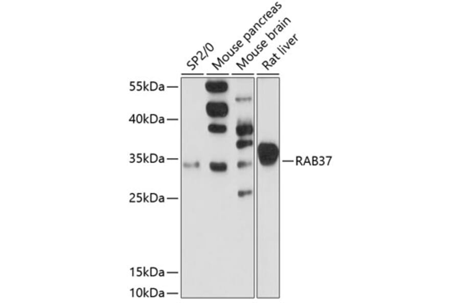Western Blot - Anti-RAB37 Antibody (A13704) - Antibodies.com