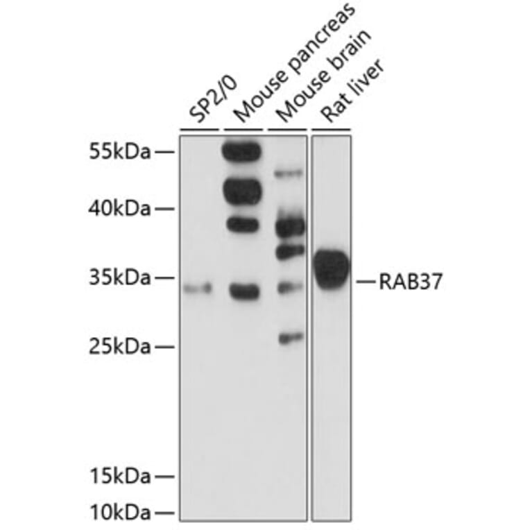 Western Blot - Anti-RAB37 Antibody (A13704) - Antibodies.com