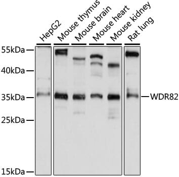 Western blot analysis of extracts of various cell lines, using Anti-WDR82 Antibody (A15518) at 1:1,000 dilution.
Secondary antibody: Goat Anti-Rabbit IgG (H+L) (HRP) (AS014) at 1:10,000 dilution.
Lysates / proteins: 25µg per lane.
Blocking buffer: 3% non-fat dry milk in TBST.
Detection: ECL Basic Kit (RM00020).
Exposure time: 10s.