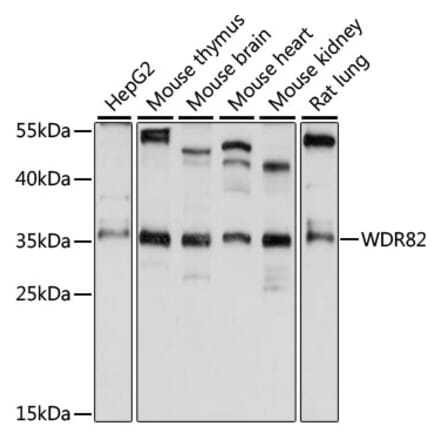 Western Blot - Anti-Swd2 Antibody (A89392) - Antibodies.com