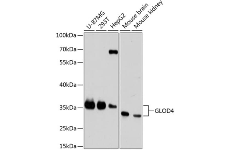 Western Blot - Anti-GLOD4 Antibody (A89393) - Antibodies.com