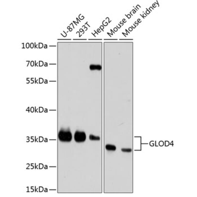 Western Blot - Anti-GLOD4 Antibody (A89393) - Antibodies.com