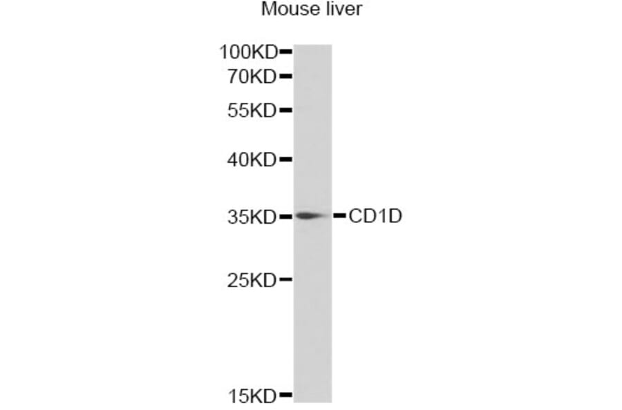Western Blot - Anti-CD1D Antibody (A13475) - Antibodies.com