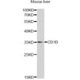 Western Blot - Anti-CD1D Antibody (A13475) - Antibodies.com