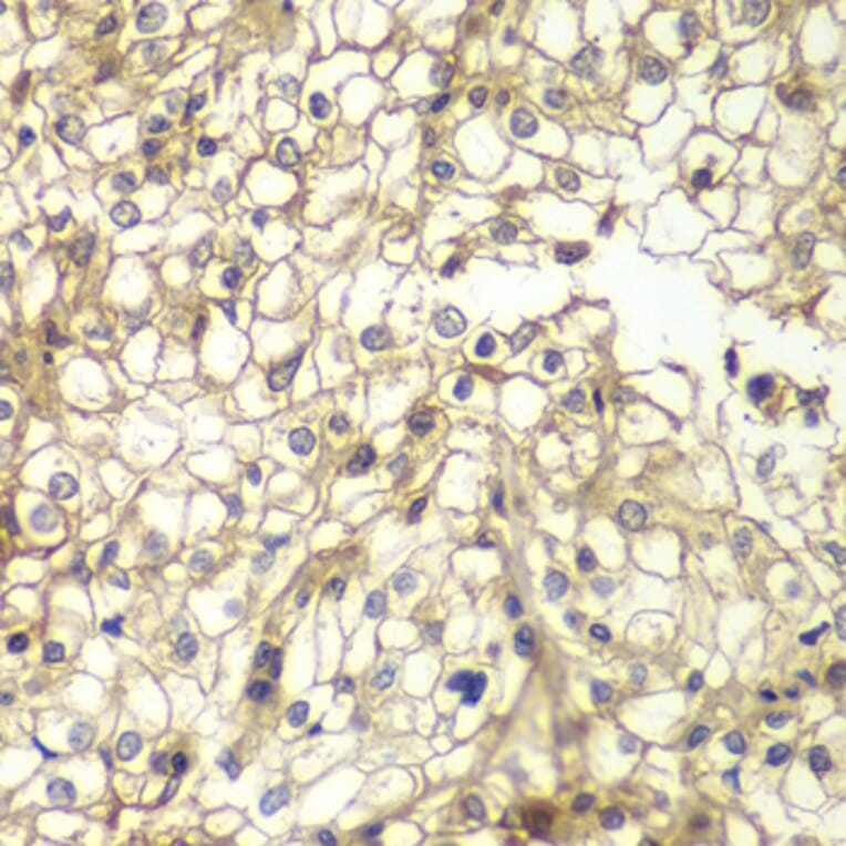 Immunohistochemistry - Anti-CD1D Antibody (A13475) - Antibodies.com