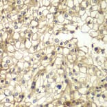 Immunohistochemistry - Anti-CD1D Antibody (A13475) - Antibodies.com