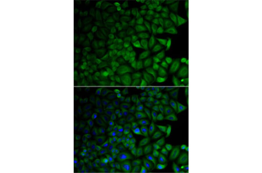 Immunofluorescence - Anti-CD1D Antibody (A13475) - Antibodies.com