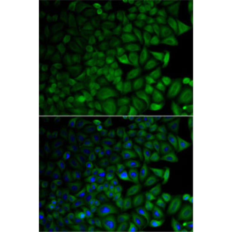 Immunofluorescence - Anti-CD1D Antibody (A13475) - Antibodies.com