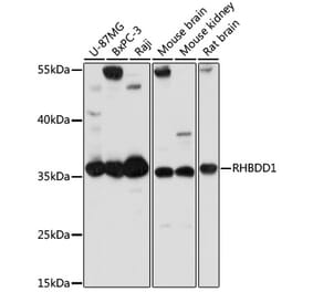 Western Blot - Anti-RHBDD1 Antibody (A89395) - Antibodies.com