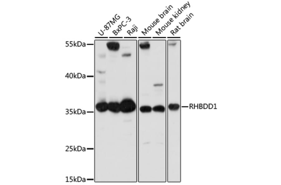 Western Blot - Anti-RHBDD1 Antibody (A89395) - Antibodies.com
