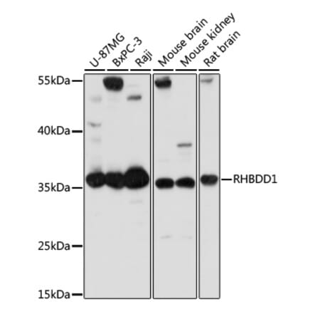 Western Blot - Anti-RHBDD1 Antibody (A89395) - Antibodies.com