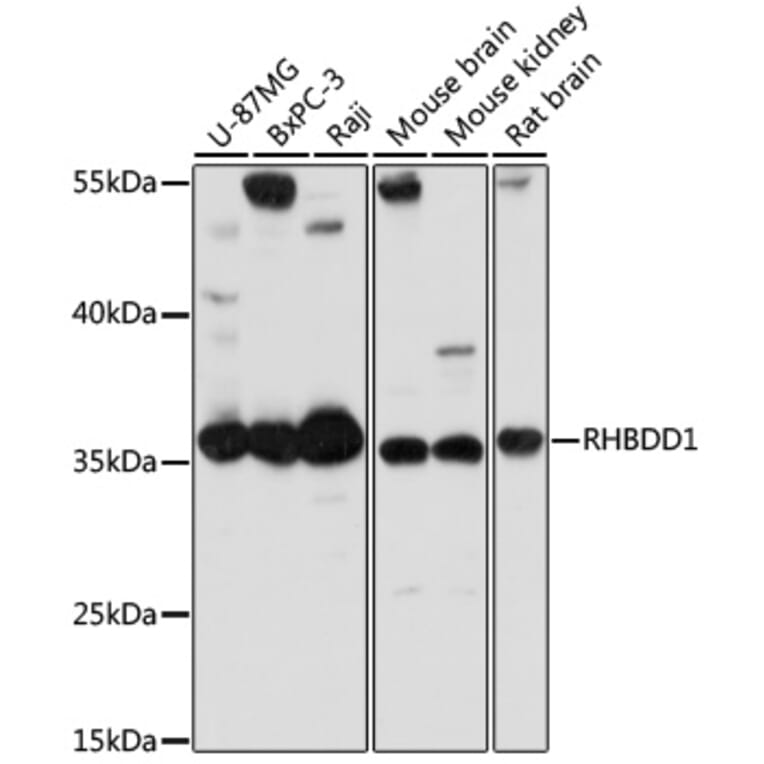 Western Blot - Anti-RHBDD1 Antibody (A89395) - Antibodies.com