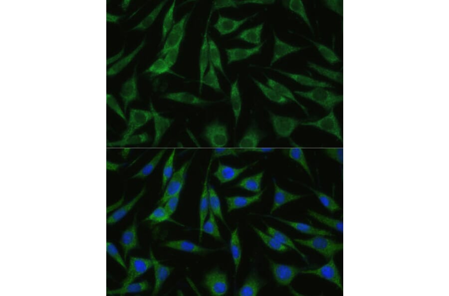 Immunofluorescence - Anti-RHBDD1 Antibody (A89395) - Antibodies.com
