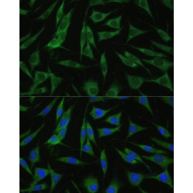 Immunofluorescence - Anti-RHBDD1 Antibody (A89395) - Antibodies.com