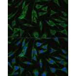 Immunofluorescence - Anti-RHBDD1 Antibody (A89395) - Antibodies.com