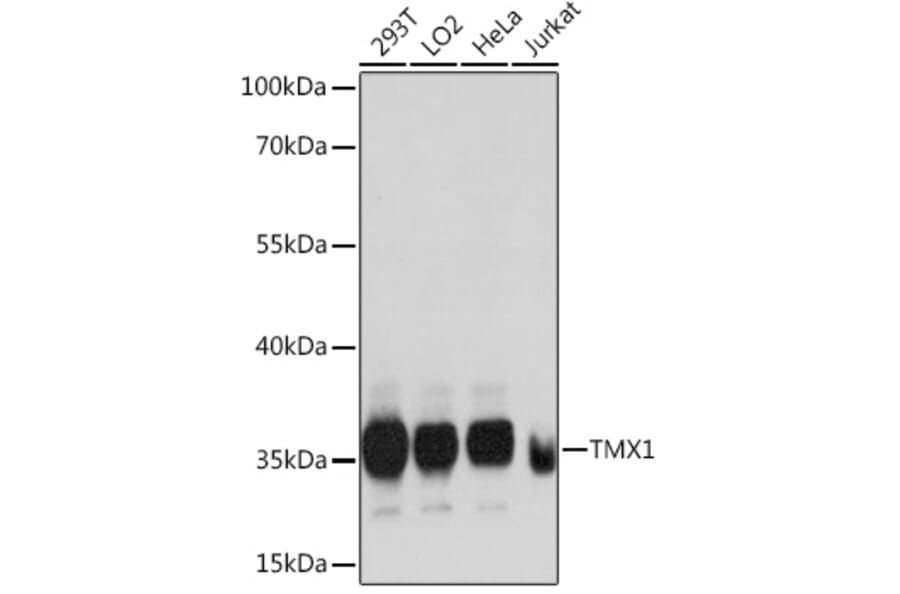 Western Blot - Anti-TMX Antibody (A89396) - Antibodies.com