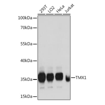 Western Blot - Anti-TMX Antibody (A89396) - Antibodies.com