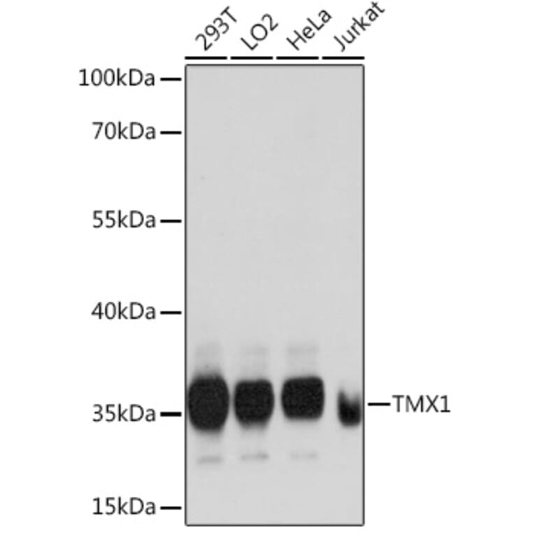 Western Blot - Anti-TMX Antibody (A89396) - Antibodies.com