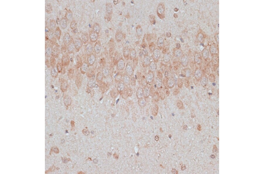 Immunohistochemistry - Anti-TMX Antibody (A89396) - Antibodies.com