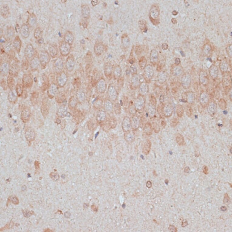 Immunohistochemistry - Anti-TMX Antibody (A89396) - Antibodies.com
