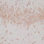 Immunohistochemistry - Anti-TMX Antibody (A89396) - Antibodies.com
