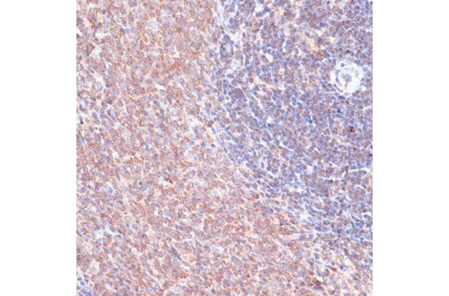 Immunohistochemistry - Anti-TMX Antibody (A89396) - Antibodies.com